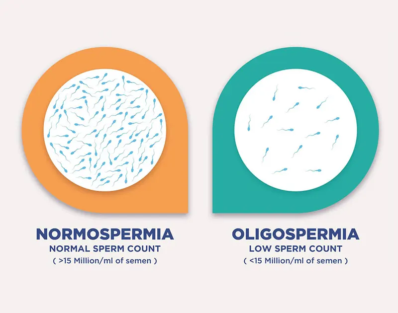 OLIGOZOOSPERMIA